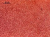 7 - Cellule corticali in visione superficiale